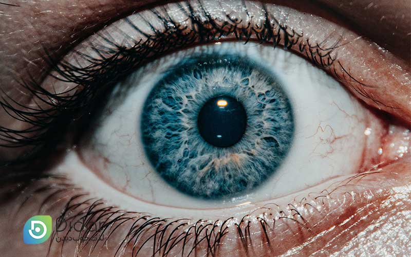 تیروئید-چشمی-چیست؟-علائم،-تشخیص-و-راه-های-درمان-تیروئید-چشمی